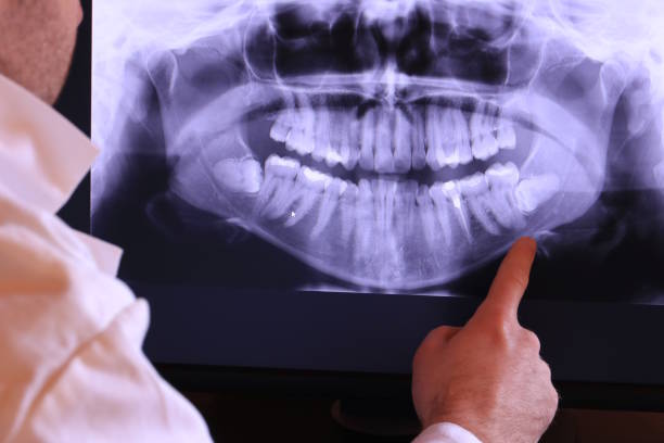 Best Chipped Tooth Repair Near Me  in Bayou La Batre, AL