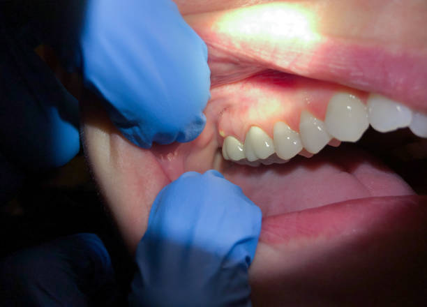 Best Teeth Whitening  in Bayou La Batre, AL